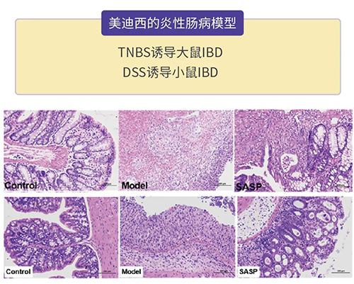K8官网的炎症性肠病模型